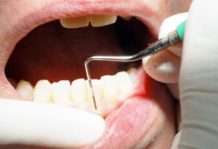 Celebrating the first European Day of Periodontology