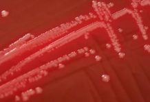 Association between biofilm and infection