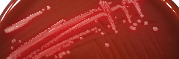 Association between biofilm and infection