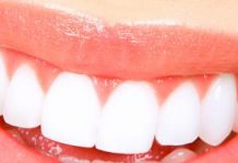 Oral factors that influence bacterial growth smile