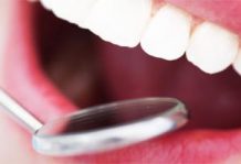 Periodontal disease and systemic diseases