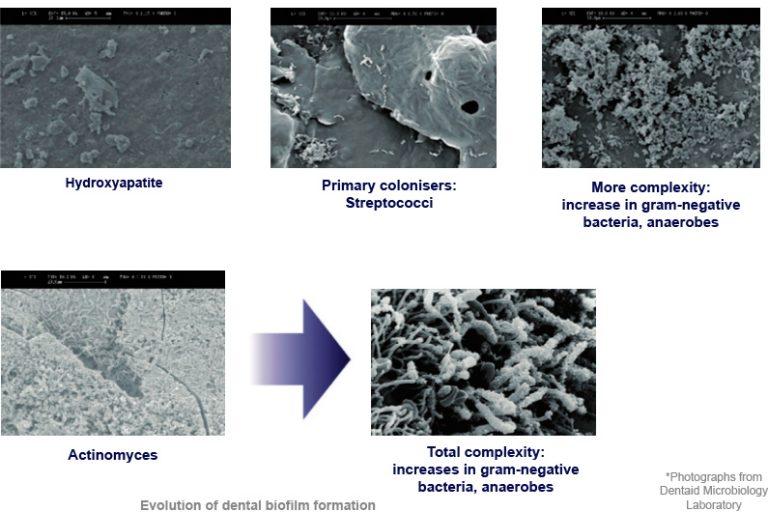 Oral biofilm formation Perio Expertise